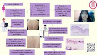 PITIRIASIS VERSICOLOR  Microbiología e Infectología médica UNIVERSIDAD NACIONAL DEL SANTA [upl. by Torrlow629]