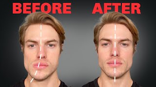 How to Fix Asymmetrical Jaw amp Face FOREVER [upl. by Bobbe546]