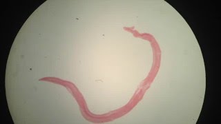 Schistosoma mansoni ♂ [upl. by Larkins406]