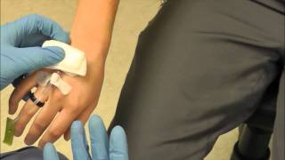 How to Remove an IV [upl. by Isaak]