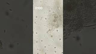 Flagellate Filter Feeding cell microscope music ponds life evolution [upl. by Castera]