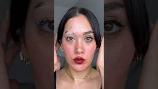 Sharing one of my fav videos as a reminder that no skin is bad 🤍 vitiligo acne poliosis skin [upl. by Idnahr]