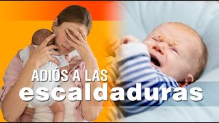 Las escaldaduras en los bebés  síntomas causas y soluciones [upl. by Nolahc]