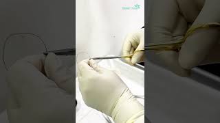 Biopsy for histopathology  Dhaka Dermatology Institute  LaserTreat [upl. by Mode]