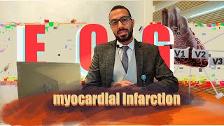 Myocardial Infarction Treatment علاج جلطات القلب [upl. by Leugar]