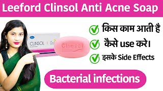 Clinsol Anti Acne Soap  Clinsol Anti Acne Soap Uses in Hindi  Clinsol Anti Acne Soap Review [upl. by Blader]