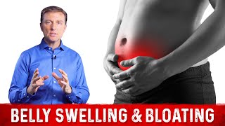 Swollen Belly amp Bloating As Day Progresses – Dr Berg on Bloated Stomach [upl. by Robet949]