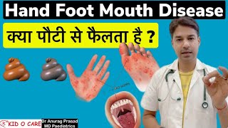 कैसे फैलता है HFM Spread  Transmission of Hand Foot Mouth Disease Dr Anurag Prasad Hindi [upl. by Angelita]