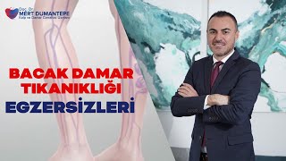 Bacak Damar Tıkanıklığı Egzersizleri Nelerdir  PROF DR MERT DUMANTEPE [upl. by Rochus166]