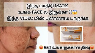 face black mark remove cream best result tamil [upl. by Kentigera]