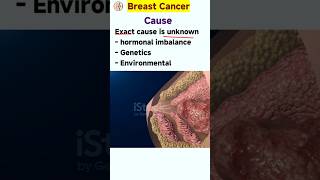 Breast cancer symptoms  breast cancer ke lakshan  breast cancer kaise hota hai [upl. by Afas]