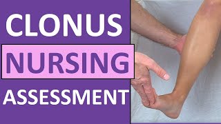 Clonus Test Positive Reflex Sign Preeclampsia Pregnancy  Nursing Skills [upl. by Gridley]