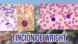 Tinción de Wright [upl. by Geraud]