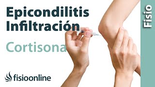 Epicondilitis o codo de tenista y las infiltraciones de cortisona o corticoides [upl. by Berkin]