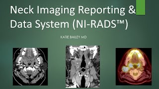 Neck Imaging Reporting and Data System NIRADS Introduction [upl. by Arten60]