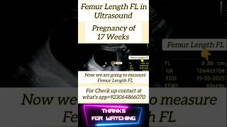 Femur Length FL In Ultrasound shorts [upl. by Ettesel]