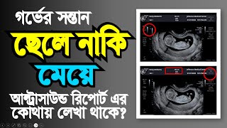 আল্ট্রাসনোগ্রাম রিপোর্ট দেখে কিভাবে বুঝবেন গর্ভের বাচ্চা ছেলে না মেয়ে  pregnancy ultrasound report [upl. by Ynes]