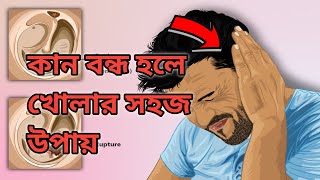 কান বন্ধ হলে করণীয়  kan bondho hole koronio kan bondho hole ki korbo [upl. by Nowujalo478]