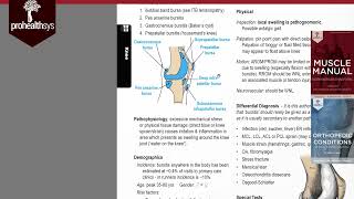 Knee Bursitis  swelling Dr Vizniak [upl. by Paxton]