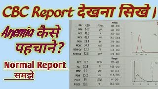 cbc blood test kya hota hai  cbc blood test  cbc blood test report in hindi [upl. by Euqinomahs]