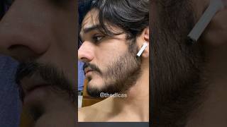 EVOLUÇÃO COM MINOXIDIL 1 ANO DE TRATAMENTO minoxidil barba thedicass [upl. by Vivyan]