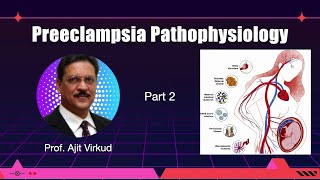 Preeclampsia Masterclass Part 2 [upl. by Zurheide]