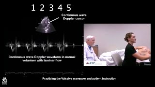 How to Equalize Ear Pressure using the Valsalva Maneuver while SCUBA diving [upl. by Atika]