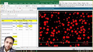 Particle count and Area Fracture study for Spheroidal Graphite Ductile Cast Iron [upl. by Sternberg566]