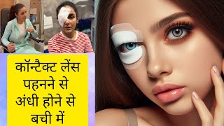 Jasmin Bhasin Suffers Severe Eye Injury after Wearing Lenses Eyecare Expert [upl. by Ariaet]