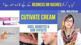 Cutivate Cream Fluticasone Propionate 0 05  Uses Side Effects Application  O Beauty Dose [upl. by Vaientina631]