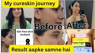 Finally I reveal my cureskin journey  Honest review of cureskin  How to use cureskin app ❤ [upl. by Atiugram452]