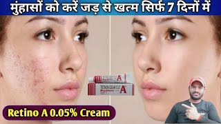 Retino A 005 Cream use dose benefits and side effects full review in hindi [upl. by Nahamas623]