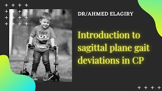 Introduction to sagittal plane deviations of gait in CP [upl. by Ytoc]