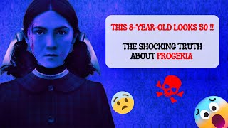 This 8 Year Old Looks 80 The Shocking Truth About Progeria 😱👴👶 [upl. by Bathesda]