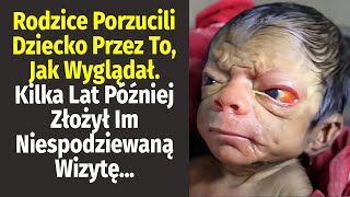 Rodzice Porzucili Niemowlę Przez Jego Wygląd Lata Później Złożył Im Nieoczekiwaną Wizytę [upl. by Ecydnak]