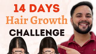 14 Days Extreme Hair Growth Challenge Thicker amp Longer Hair in 2 Weeks [upl. by Luigino53]