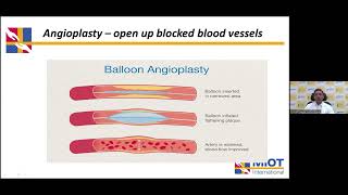 MIOT Hospital amp The Hindu Present Genicular Artery Embolization [upl. by Ludovico]