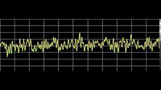 Muscular Dystrophyies  Rife Frequencies [upl. by Sandler]