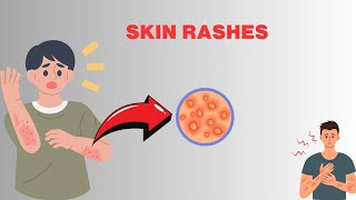 Skin rashescauses  diagnosis symptoms treatment [upl. by Danas433]