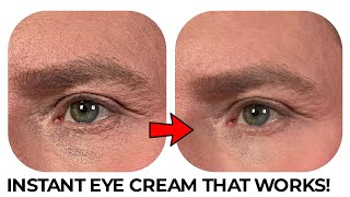 THE INSTANT EYE CREAM THAT WORKS IMMEDIATELY [upl. by Knowle]