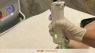 Séance dépilation laser à la Clinique Médicis Paris [upl. by Bucella]