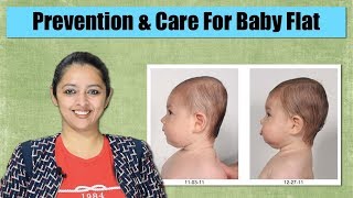 How To Maintain Baby Head Shape  Flat Head Prevention And Cure [upl. by Aiken]