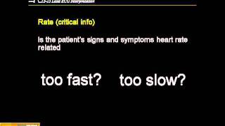 1215 Lead ECG Step by Step Approach [upl. by Norah280]