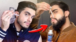 Como usar MINOXIDIL para crescer BARBA 🧔🏻‍♂️ [upl. by Suoivatram]