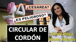 CIRCULAR DE CORDON POR GINECOLOGA DIANA ALVAREZ [upl. by Swagerty]