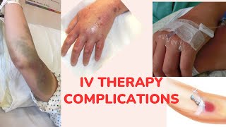 IV therapy Complications 💉🩸nclexrn nclexreview nursing education nursingexam nclex viral [upl. by Nazus925]