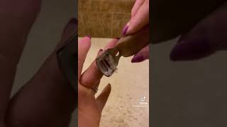 Fingertip maintenance with palmoplantar keratoderma hand callus EPPK  Apr 8 2023 [upl. by Tamanaha]