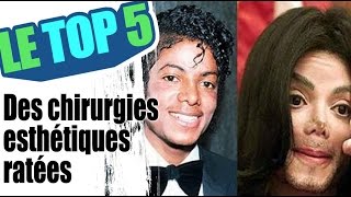 Le top 5 des chirurgies esthétiques ratées [upl. by Eizzil]