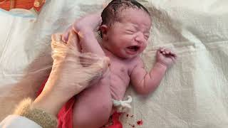 Breech delivery of beautiful newborn baby viral baby [upl. by Anivid]