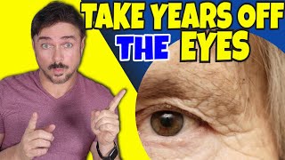 Take 20 Years Off Your Eye Area  Chris Gibson [upl. by Hoffman]